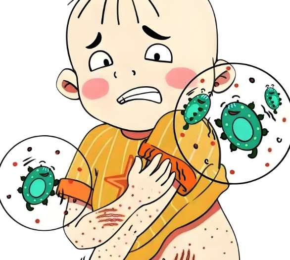 塵 蟎 過敏​