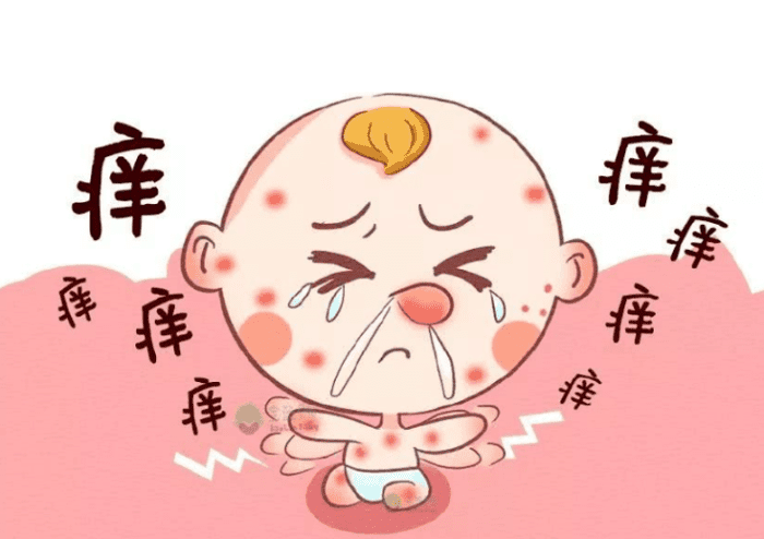 嬰兒 過敏 紅 疹