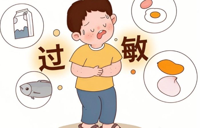 食物過敏緊急處理 食物過敏緊急處理