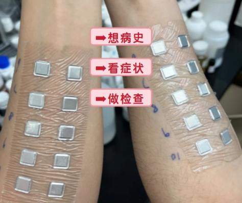 過敏 檢測