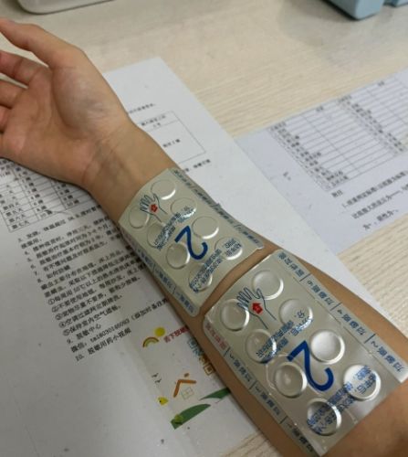 測過敏原掛什麼科 測過敏原掛什麼科