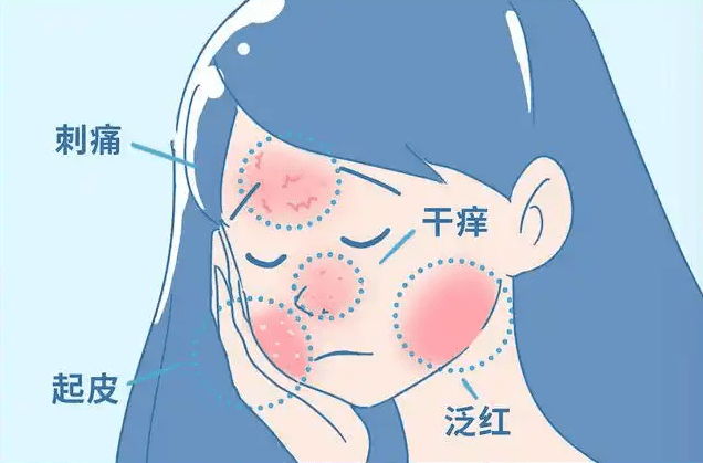 臉 過敏 怎麼 辦