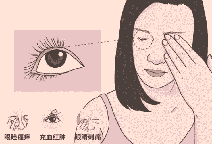 眼睛過敏 眼睛過敏
