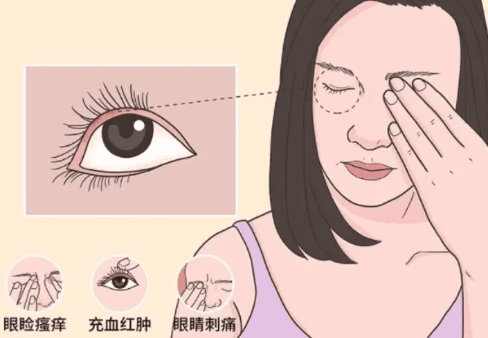 眼睛周圍過敏原因 眼睛周圍過敏原因