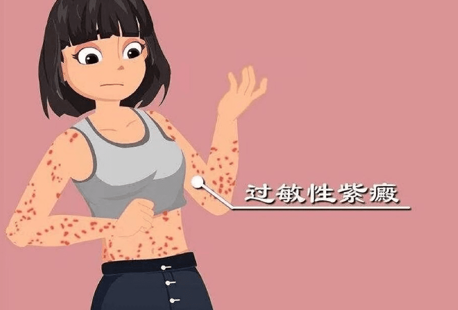 過敏性紫斑症原因 過敏性紫斑症原因