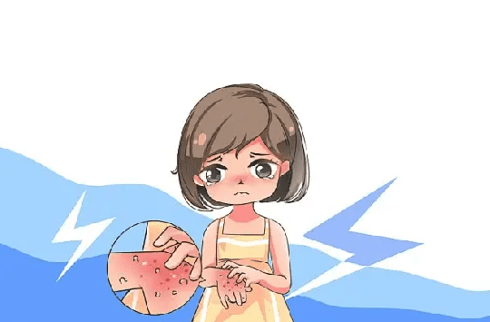 海鮮過敏治療 海鮮過敏治療