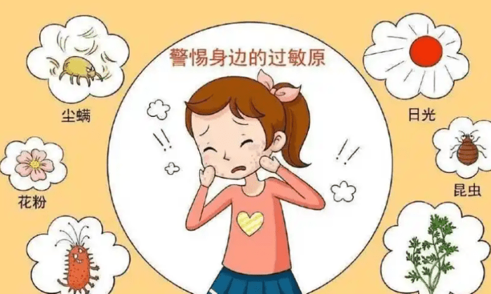 臉過敏紅腫急救